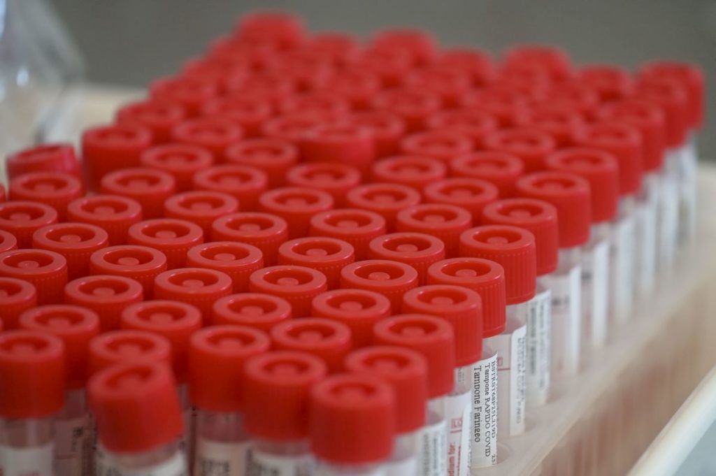 MONZA (MILANO) (ITALPRESS) - L'Agenzia Italiana del Farmaco (AIFA) ha approvato l'immissione al...