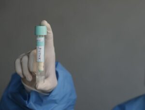 Covid, sale l’incidenza settimanale