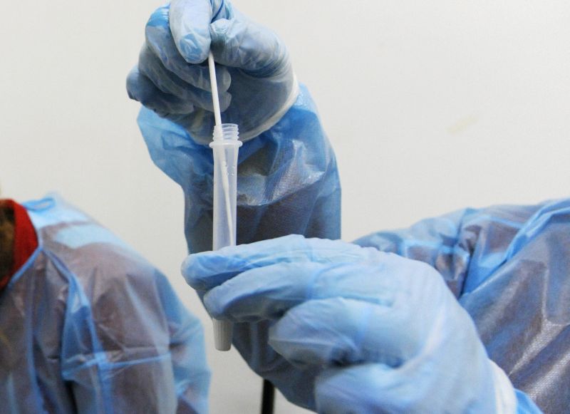 ROMA (ITALPRESS) - Sono 93.157 i nuovi casi di Coronavirus in Italia (ieri 99.522) a fronte di...