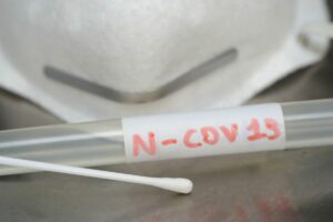 Europa, Italia Milano - Tampone e esame del sangue per rilevare la positivita' al n-cov19...