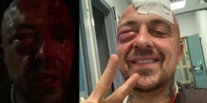 ‘In 6 mi hanno picchiato: il video shock di Chef Rubio insanguinato e tumefatto’