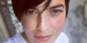 Senza naso dopo essere stata travolta da un’auto: il racconto di Edelfa Chiara Masciotta