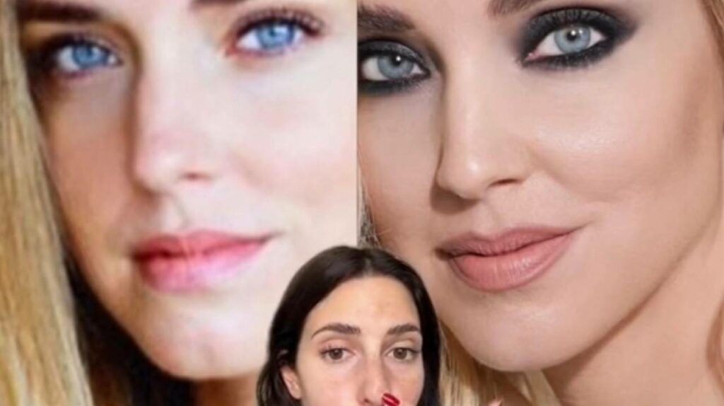 filler-botox.jpg