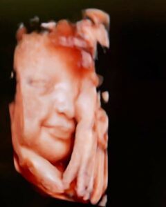 Fedez, Mi sciolgo… su Instagram delizia i suoi fan