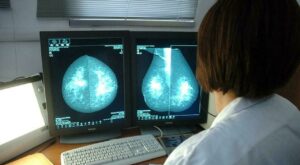 Offerta speciale: Mammografia gratuita per tutto ottobre, il mese della prevenzione del tumore al seno