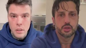 Come, quando e per quale motivo Fedez ha cercato di por fine alla sua vita