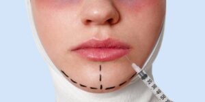 A 43 anni mi guardo allo specchio e vedo i segni del tempo. Ho ignorato i segnali delle rughe e...