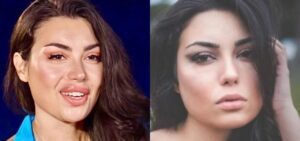 Jenny Guardiano: La sua trasformazione dopo i ritocchini e la sua scelta dopo Temptation Island 2024