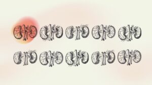 Il titolo riscritto potrebbe essere: “Malattia Renale Cronica: focus sulla prevenzione e sull’impatto economico”