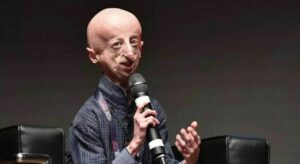 Studiando la sindrome in 150 individui per una ricerca più approfondita