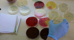 I microbi urbani mostrano sempre maggiore resistenza ai disinfettanti