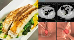 Uno studio condotto da Cnr-Ibba e Neurofarba ha dimostrato che una dieta a base di verdure e pesce è...