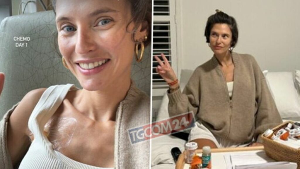 L’inizio della chemioterapia per Bianca Balti