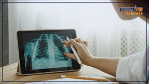 L’importanza della diagnosi precoce nelle patologie del torace