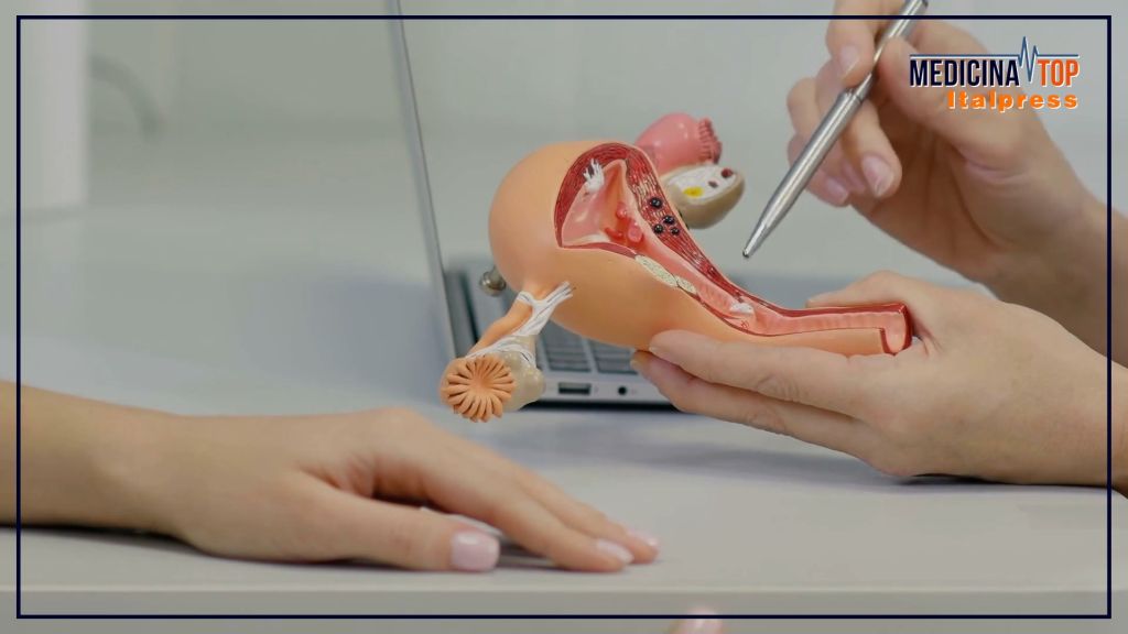 Domenico Vitobello, responsabile ginecologia Humanitas Rozzano, parla dei fibromi uterini, tumori...