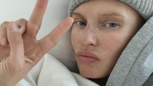 La modella esprime i suoi sentimenti di lotta e resilienza di fronte alla malattia, ma anche di...