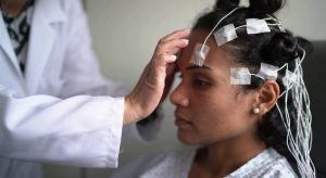 Scoperti i meccanismi di sviluppo delle regioni cognitive del cervello: una nuova prospettiva scientifica