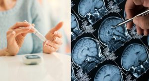 Rischio di Alzheimer: l’associazione con il diabete di tipo 2 e gli effetti sul cervello