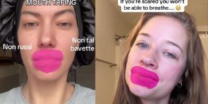 Mouth Tape: Come funziona e perché non sempre migliora il sonno