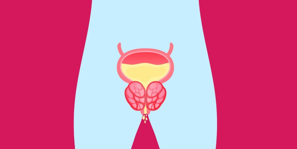 Tumore alla prostata Gleason 9: il caso di Joe Biden e le sue metastasi.