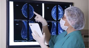 Anticorpo coniugato riduce del 44% il rischio di morte nel tumore al seno. Scopri di più!