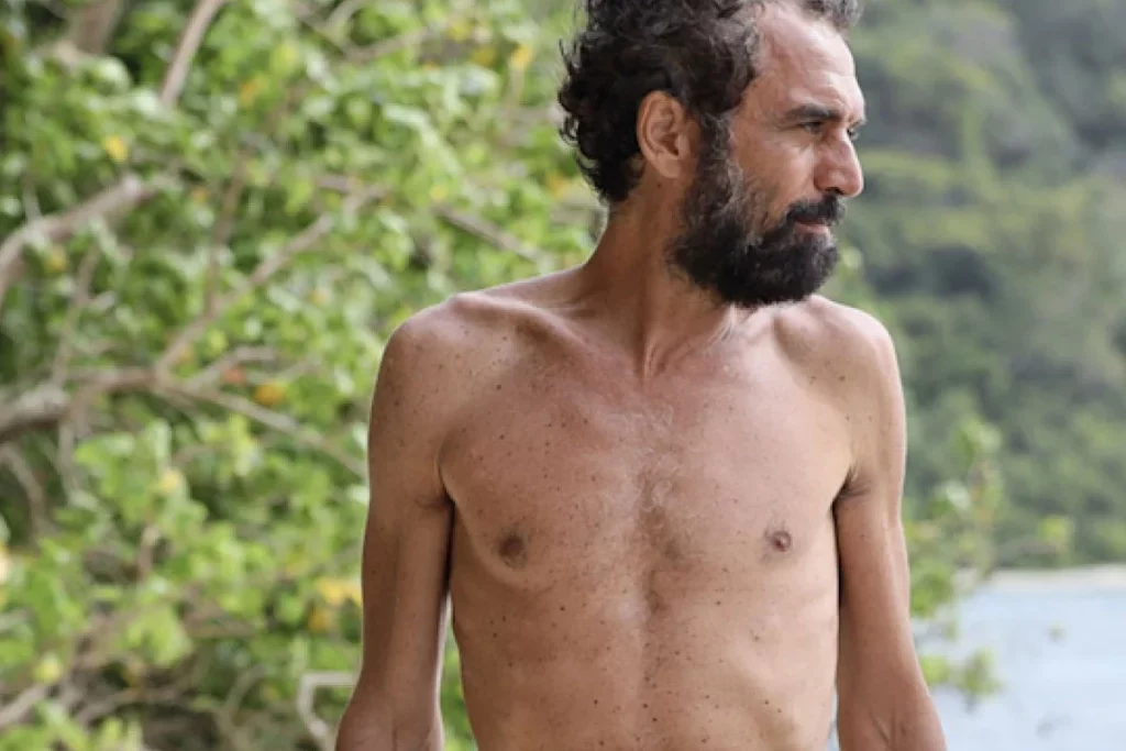 Dino Giarrusso rivela: “Dopo l’Isola dei Famosi 2025, dovrò andare in ospedale.”