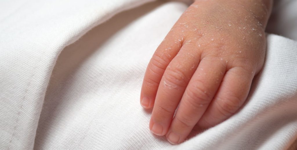 Tragedia in vacanza: bimbo di 5 mesi muore nel sonno.