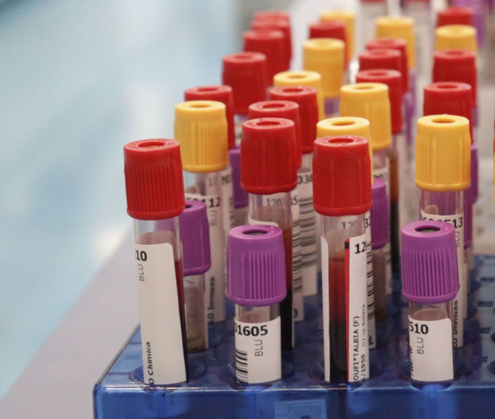 Modena: Alla Scoperta del Laboratorio di Analisi e Diagnostica dell'Ospedale di Baggiovara Un...