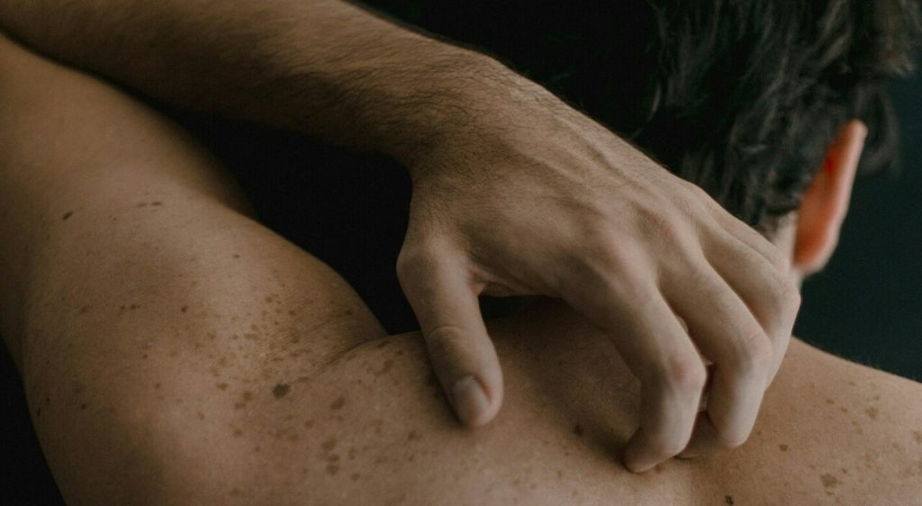 Scabbia a Settimo Torinese: ospedale in quarantena, sintomi e cure della malattia parassitaria.