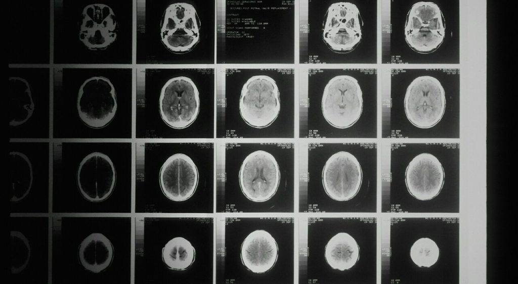 Rallentamenti: il 70% delle volte causano frustrazione e perdita di produttività