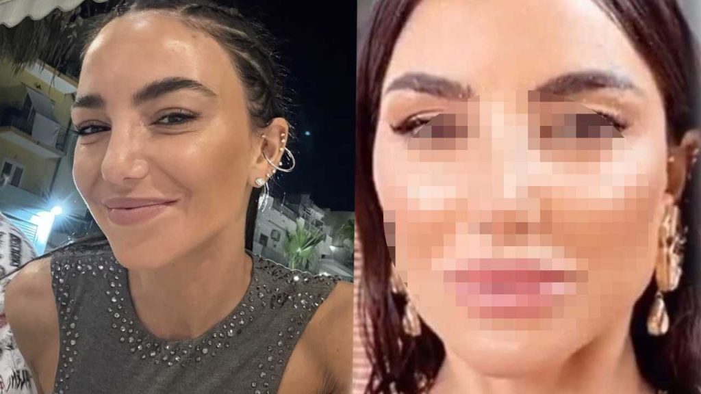 Il Viaggio di Chiara Biasi: Riflessioni sulla Chirurgia Estetica Il Punto di Partenza: Un Momento di...