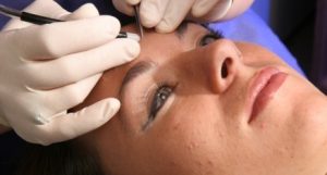 Depilazione permanente: elettrolisi o laser? Scopri la soluzione migliore per te.