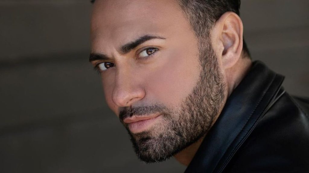 Stefano Oradei coinvolto in incidente in moto: prognosi seria per il noto ballerino.