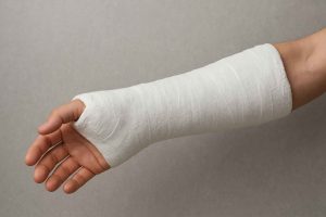 Fratture al Braccio e alla Gamba: Cosa Sapere e Come Agire Un incidente stradale, una caduta...