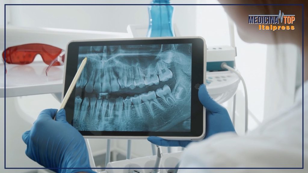 Educare i giovani all’igiene orale è essenziale per mantenere i denti sani.