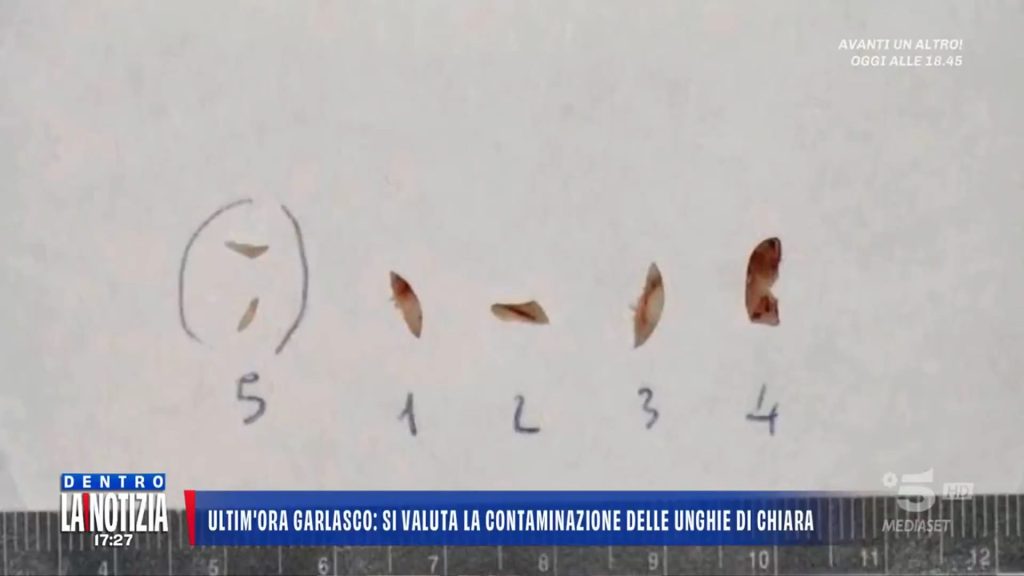 Nuove analisi per escludere contaminazione nelle unghie di Chiara Poggi a Garlasco.