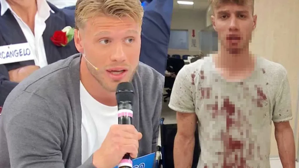 Marco Veneselli aggredito da due poliziotti: dettagli shock e conseguenze dell’aggressione