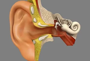 Successo impianto cocleare: vantaggi, rischi e tasso di efficacia aggiornato