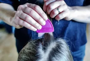 Elimina i pidocchi in una notte: prova l’aceto come repellente naturale efficace