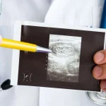 Intussuscezione: trattamento, cause, diagnosi, e sintomi