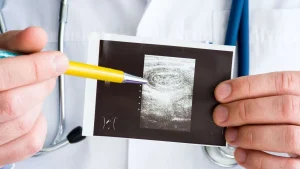 Intussuscezione: trattamento, cause, diagnosi, e sintomi