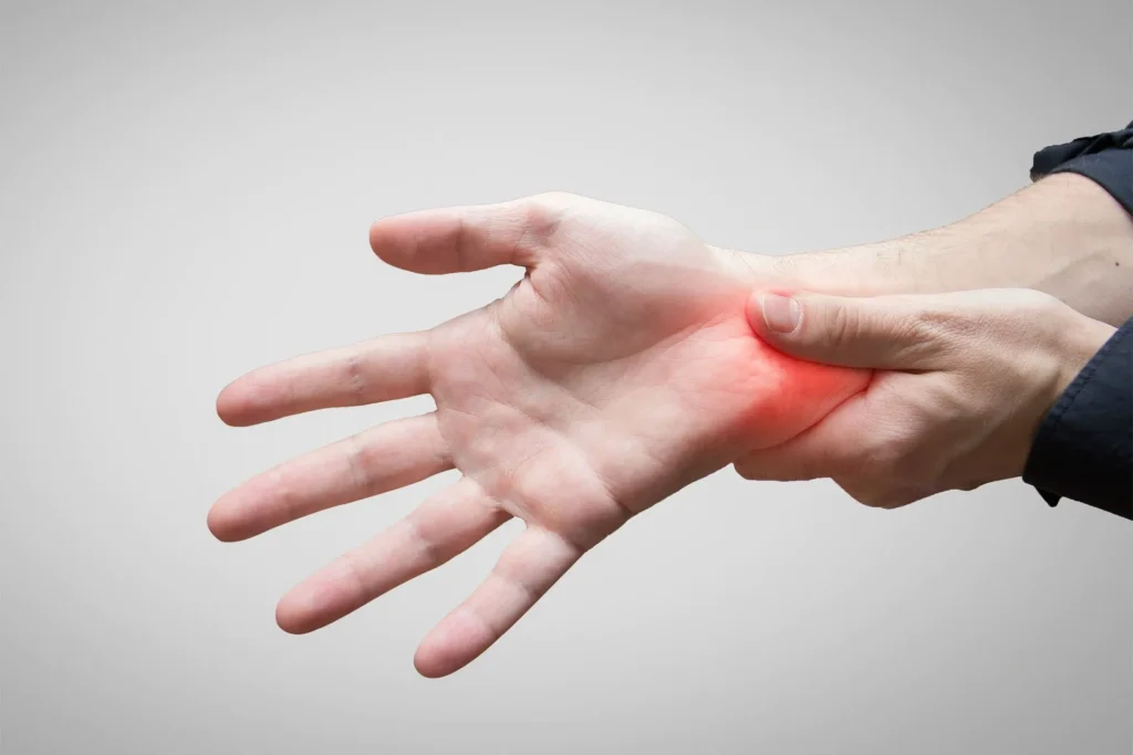 Sindrome del tunnel carpale, sintomi e rimedi efficaci