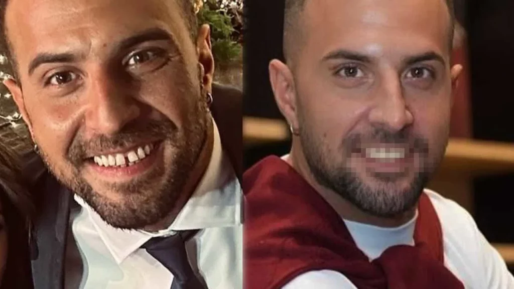 Scopri il sorprendente prima e dopo: trasformazioni che ti lasceranno senza parole!