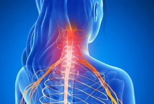 Durata e tempi di recupero dopo una laminectomia spiegati chiaramente