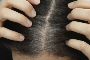 Cos’è il “fondotinta per capelli”: come si usa e la sua efficacia