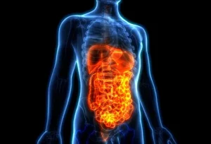 La sindrome dell’arco mediano arcuato (MALS) è una condizione che può essere curata efficacemente...