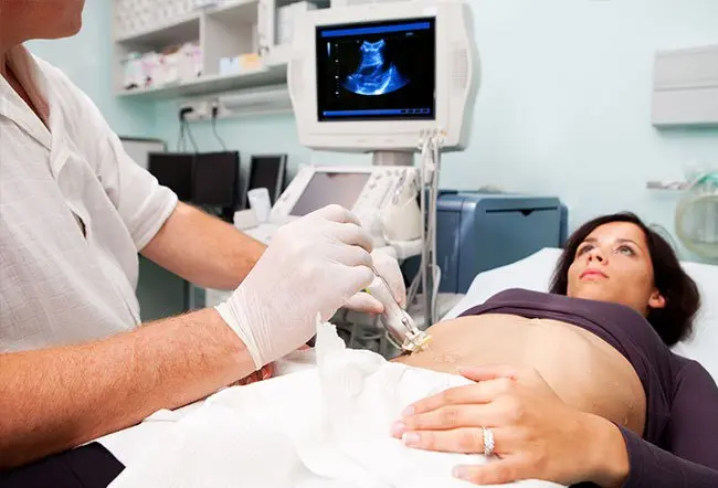 Durata di una biopsia epatica: tempi e cosa aspettarsi durante la procedura