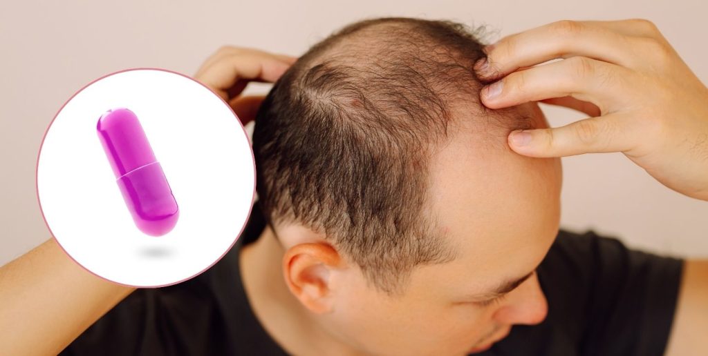 Futuro promettente: innovazioni nella ricerca contro la caduta dei capelli.