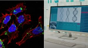L’Importanza del lncRNA nella Lotta Contro il Medulloblastoma di Gruppo 3 Una recente ricerca...