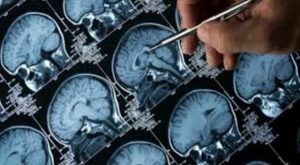Alzheimer: Rischio Maggiore nei Paesi del Nord Europa Recenti ricerche hanno rivelato un aspetto...